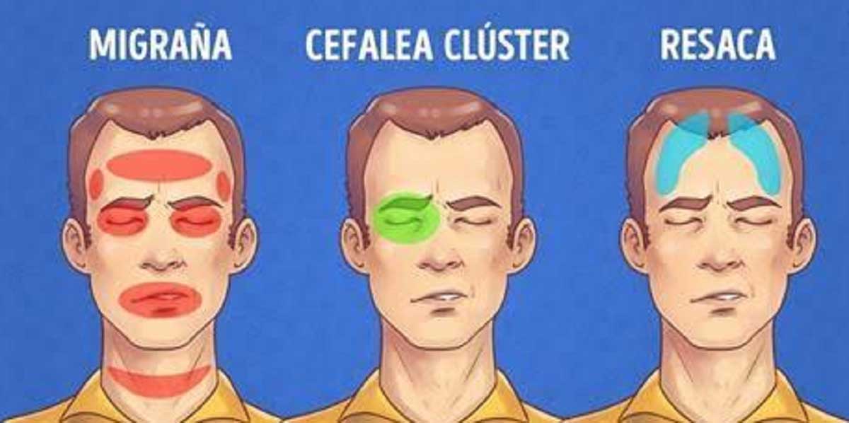 5 tipos de dor de cabeça e como aliviá-las rapidamente!